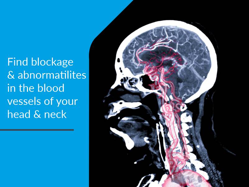 Find blockage & abnormatilites in the blood vessels of your head & neck